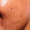 KUSUGUA EXFOLIANTE - Imagen 3