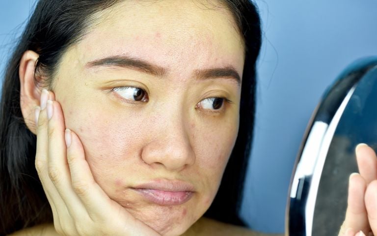 cómo mejorar la piel opaca