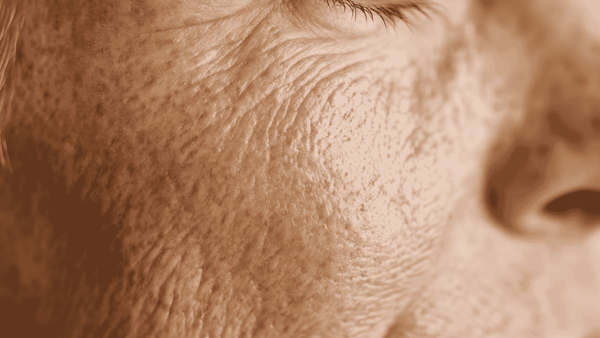 cómo mejorar la piel acartonada