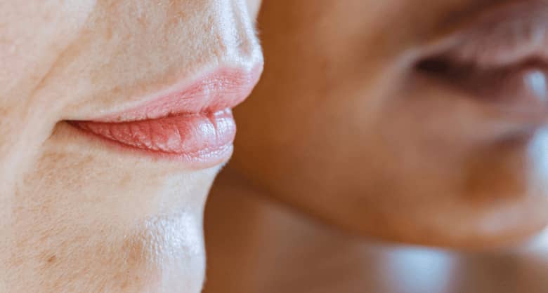 cómo mejorar la piel amarillenta