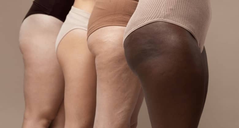 como mejorar la piel naranja