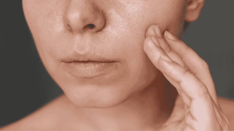 como mejorar la piel grasa