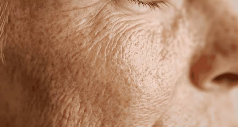 cómo mejorar la piel madura