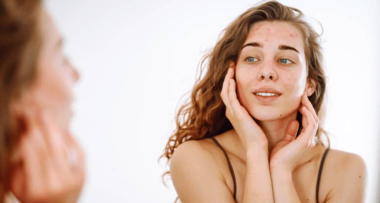 Principales problemas en la piel