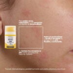 PACK Pieles atopica - aoklabs 3