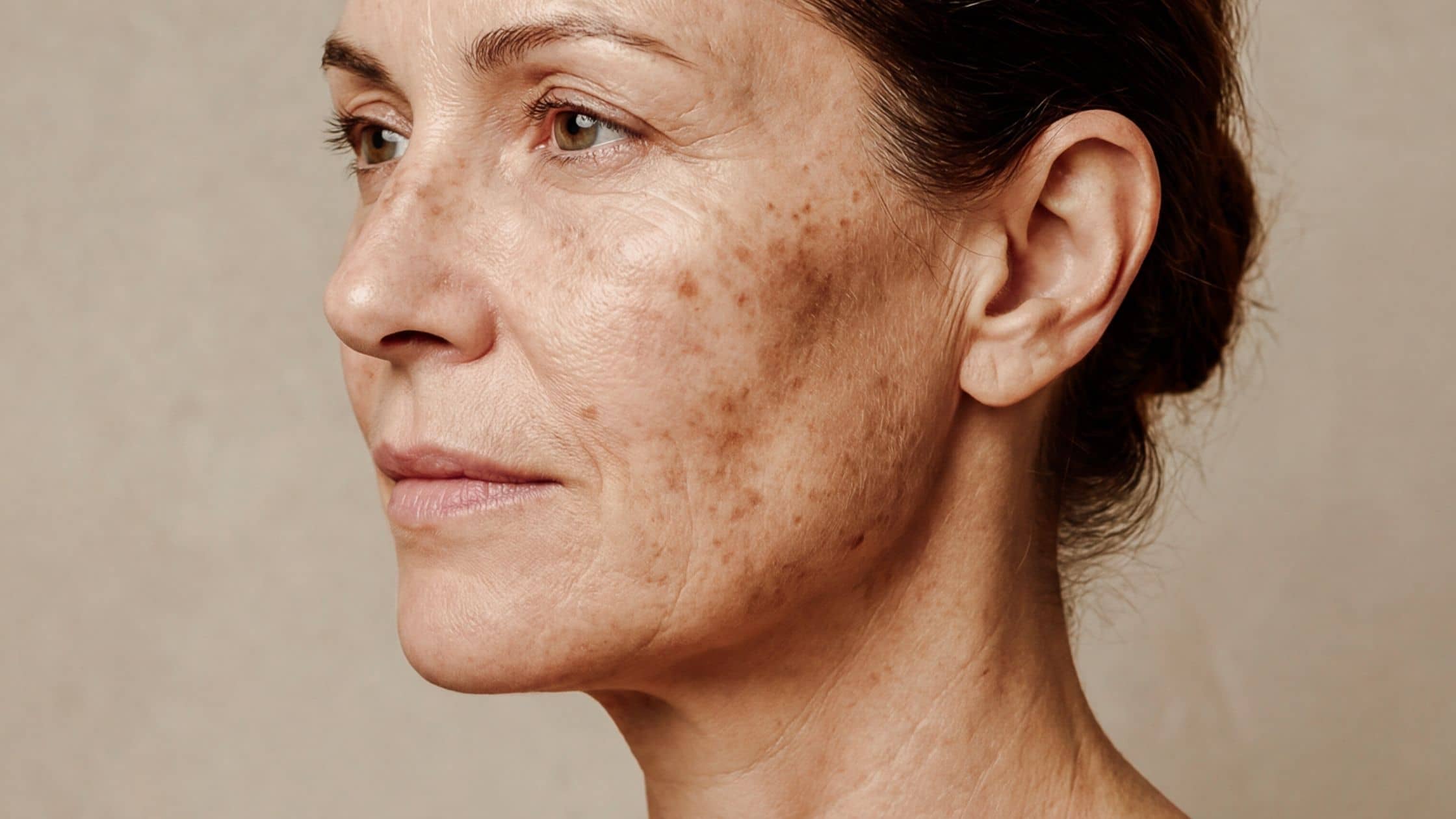 Crema para flacidez y descolgamiento facial